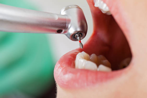 Best Holiday Emergency Dentist in Haskell, AR